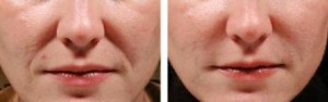 juvedermpics2-462x144