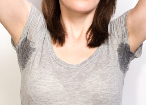 Sweating – Hyperhidrosis