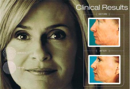 Clinical results before and after photos