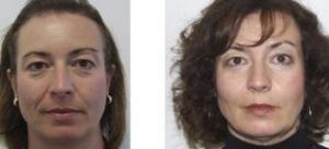 Before and after Sculptra photos