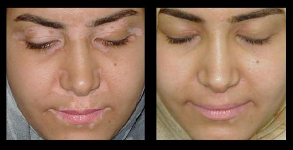 before and after photos