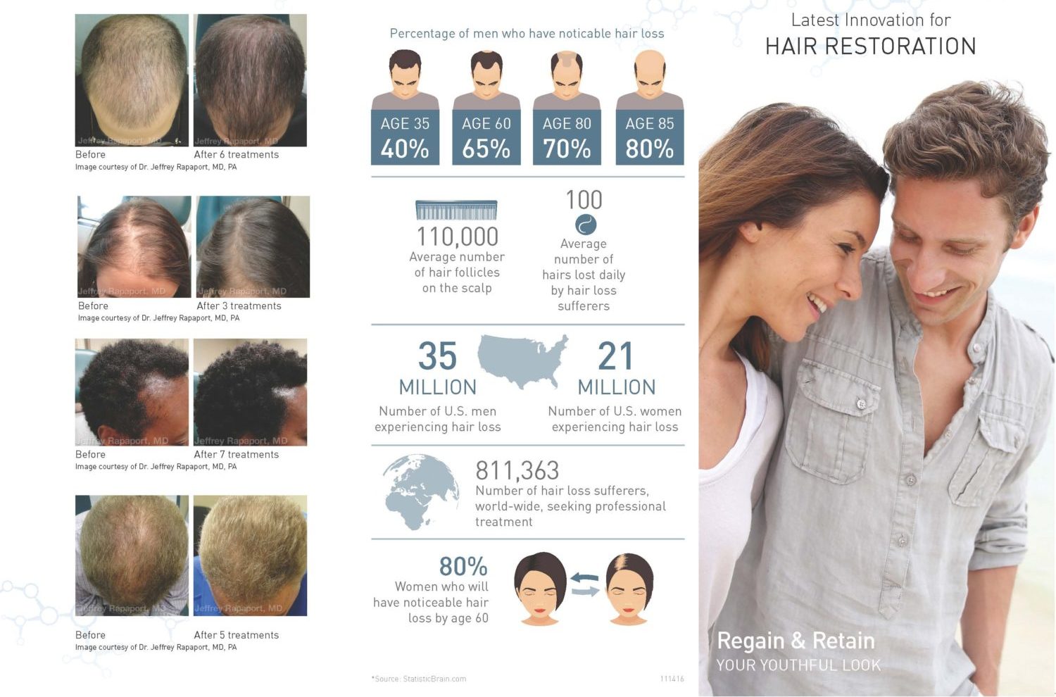 Hair Restoration | Dermatology & Laser Centre of Los Angeles