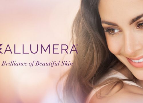 Allumera