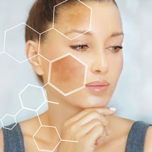 Kick Pigmentation to the Curb!
