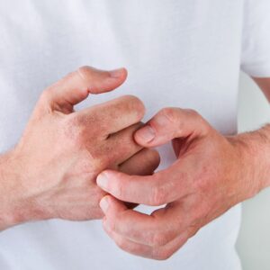 How Do You Know if You Need Systemic Medications for Psoriasis? Simi Valley, CA
